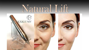 Natural Lift
