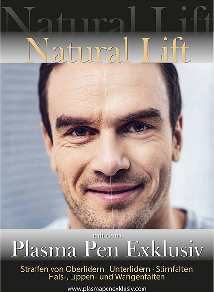 Plasma Pen Mann